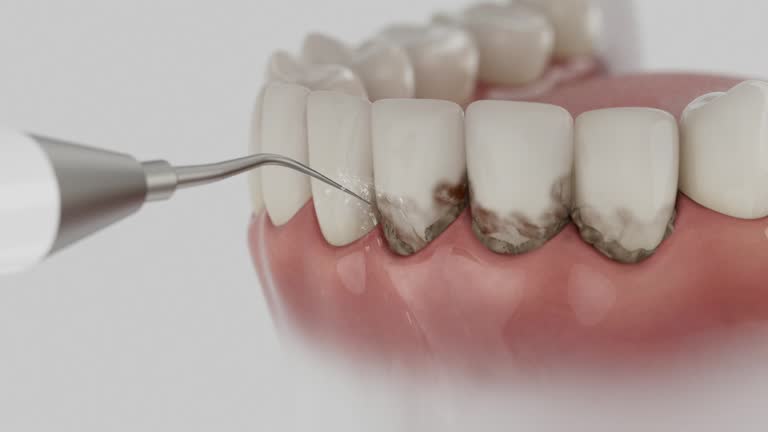 Reliable Dental contractor in Ridgecrest, CA by Smile Center Dentistry